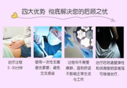 女性私密收紧项目,女性私密收紧项目全面解析