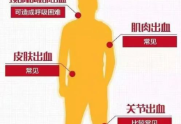 血友病的症状,从轻微出血到关节病变的全面了解